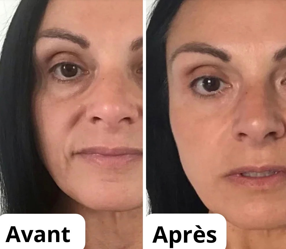 Pack 10 Masques – Clarté & Hydratation